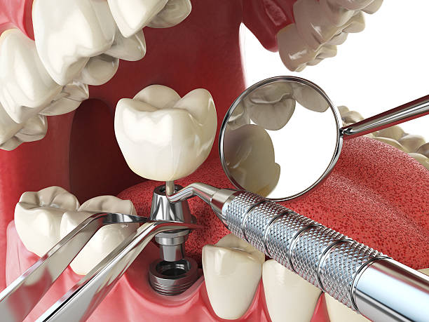 Best Emergency Denture Repair in Moorefield, WV